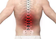 Back Pain