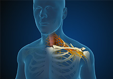 Cervical Radiculopathy/Myelopathy