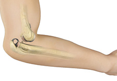 dislocation-elbow