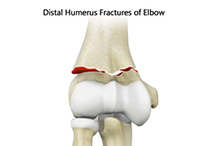 Condition Procedure Image