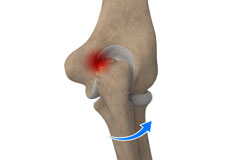 Condition Procedure Image