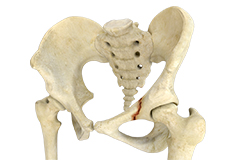 Hip Injury