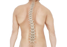 Kyphosis