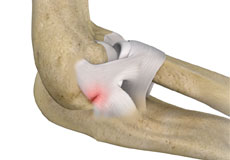 Condition Procedure Image