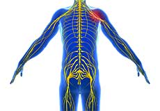 Peripheral Nerve Compression