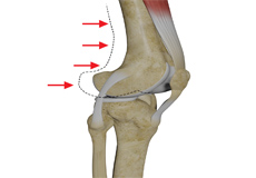 Condition Procedure Image