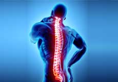 Spondyloarthropathies