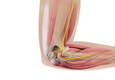 ulnar-nerve-release